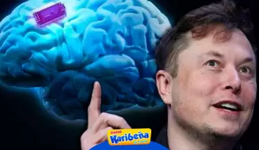 Elon Musk afirma haber implantado un chip en el cerebro de un paciente
